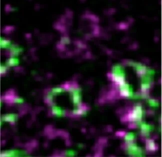 Transsynaptic nano-architecture Which mechanisms regulate trans-synaptic nano-architecture during homeostatic plasticity? Learn more