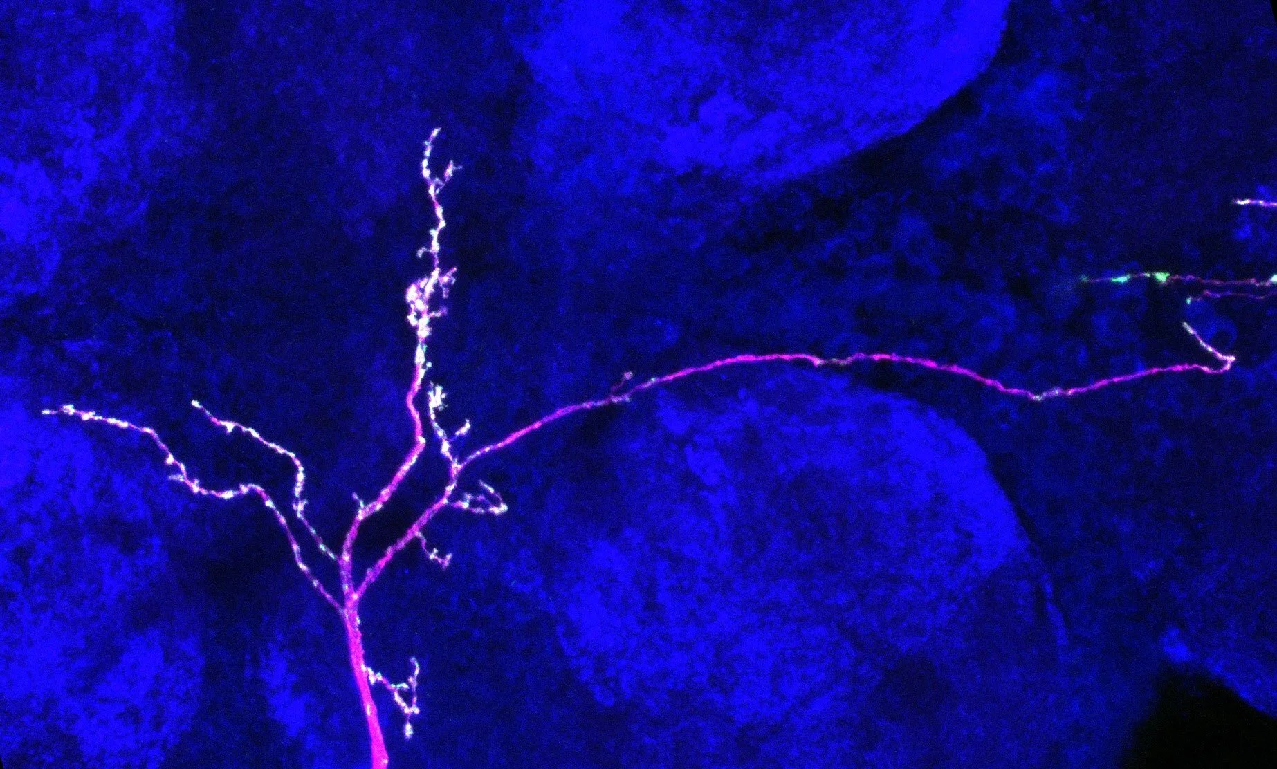 Compartment-specific synapse formation How is synapse formation robustly specified at the subcellular level in CNS axons? Learn more