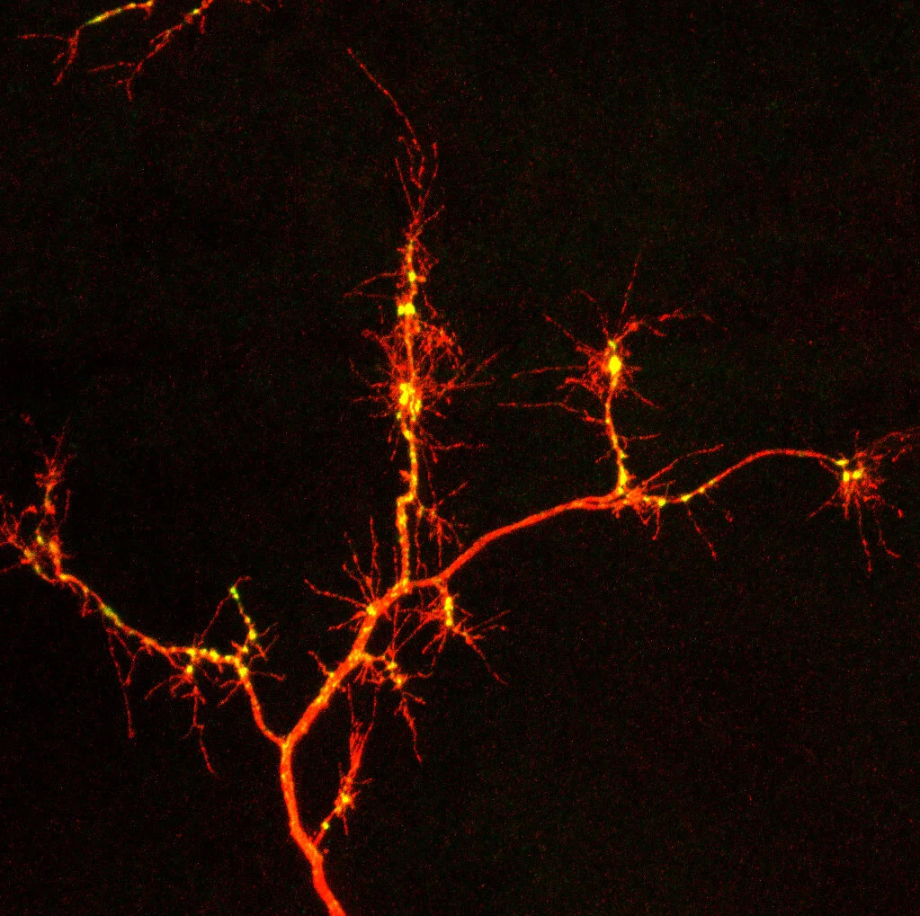 developing_axon copy.jpg