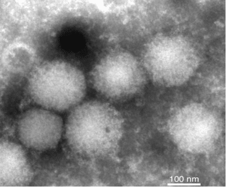 A New Virus: The ALTNV nairovirus