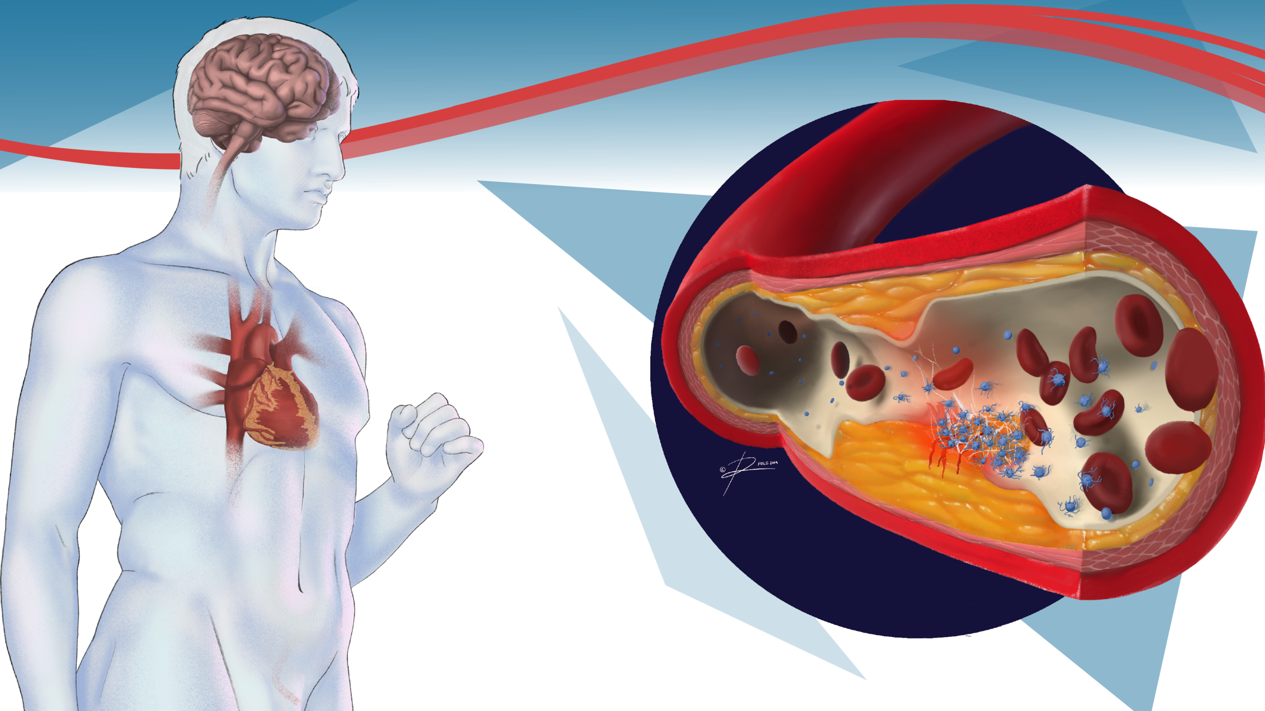 Full Figure with affected organs