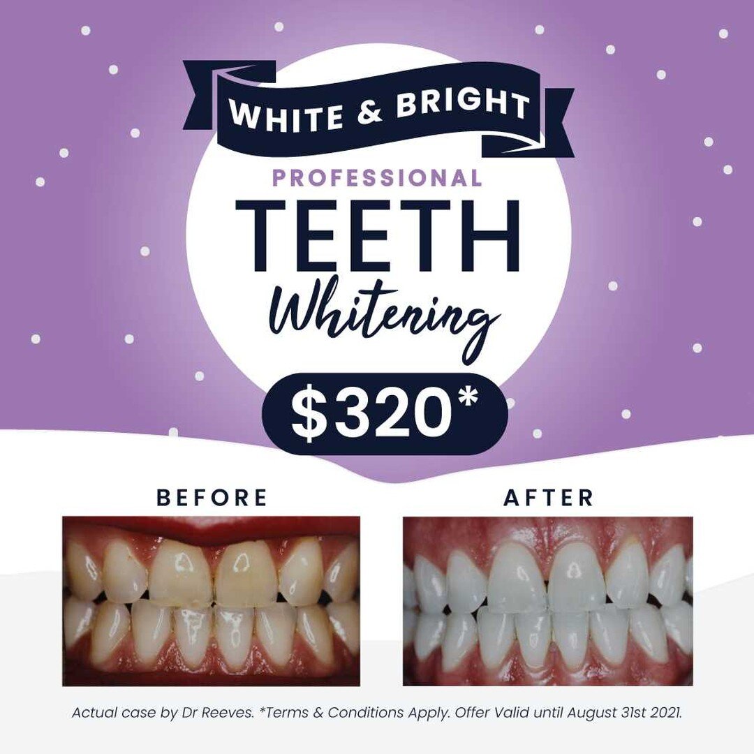 ✨ TEETH WHITENING WINTER SPECIAL - $320* ✨ 🦷As one of our most popular cosmetic dental procedures, Teeth Whitening is a great way to rejuvenate your smile 😁. The safest, most effective treatment will be provided your dentist 👩⚕️. A dental exam det