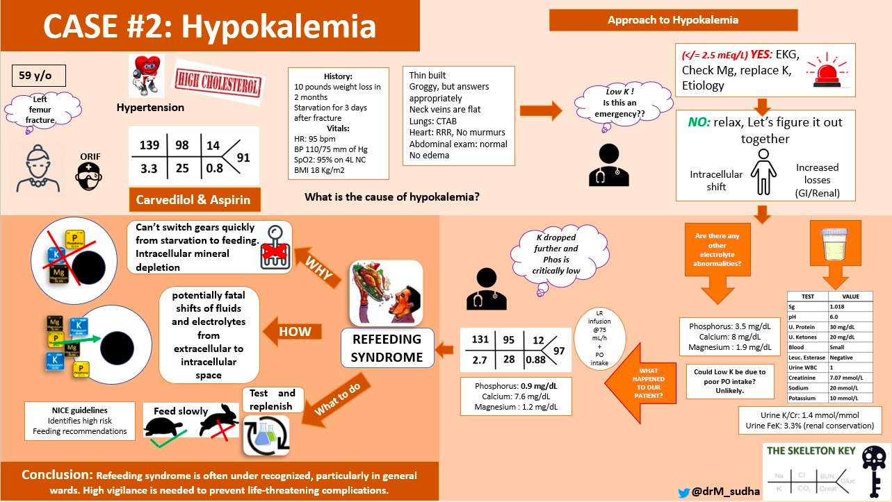 Case 2: HypokalemiaWritten by JP ArroyoVisual abstract by Sudha Mannemuddhu