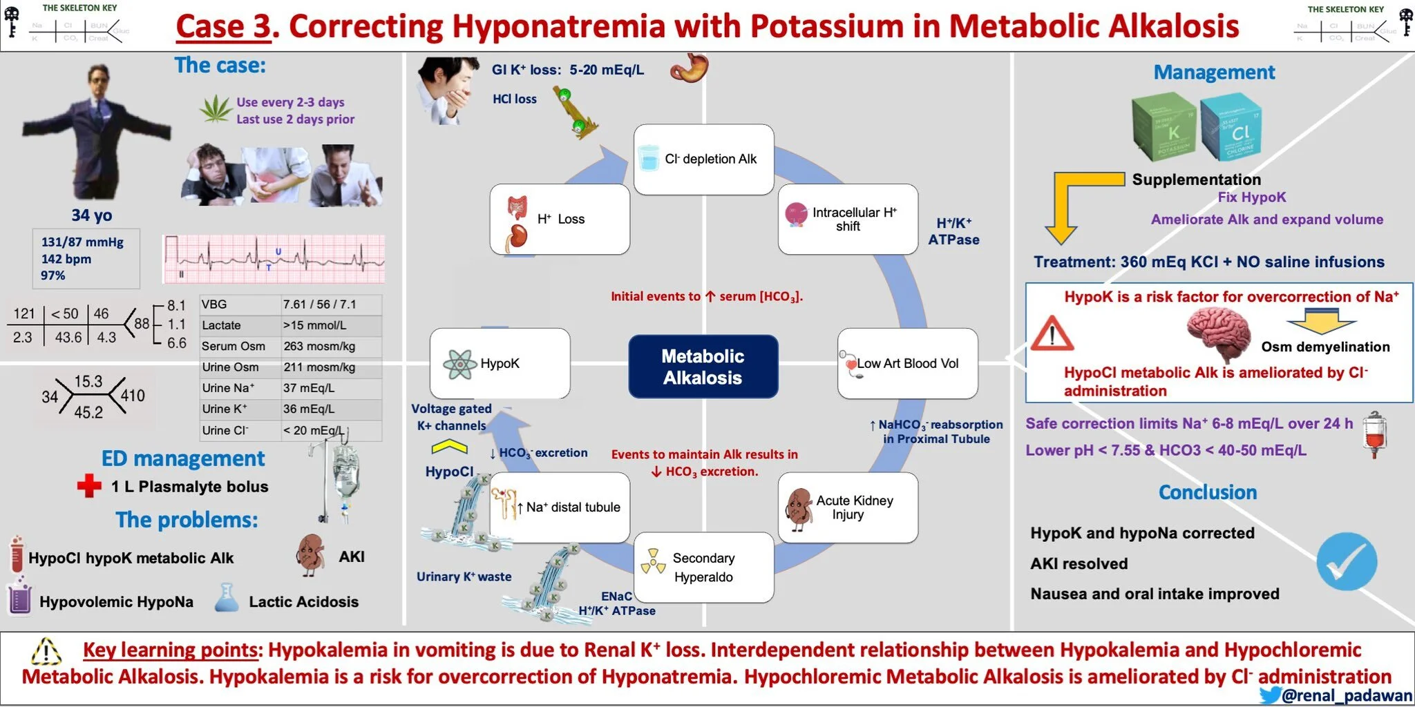 Case 3: Correcting Hyponatremia with Potassium in Metabolic AlkalosisWritten by Amy YauVisual abstract by Enzo Vasquez