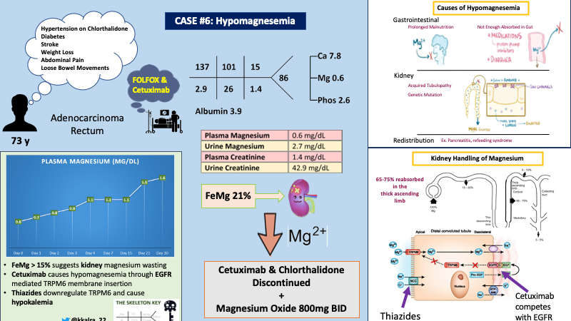 Case 6: HypomagnesemiaWritten by Dhwanil PatelVisual abstract by Kartik Karla