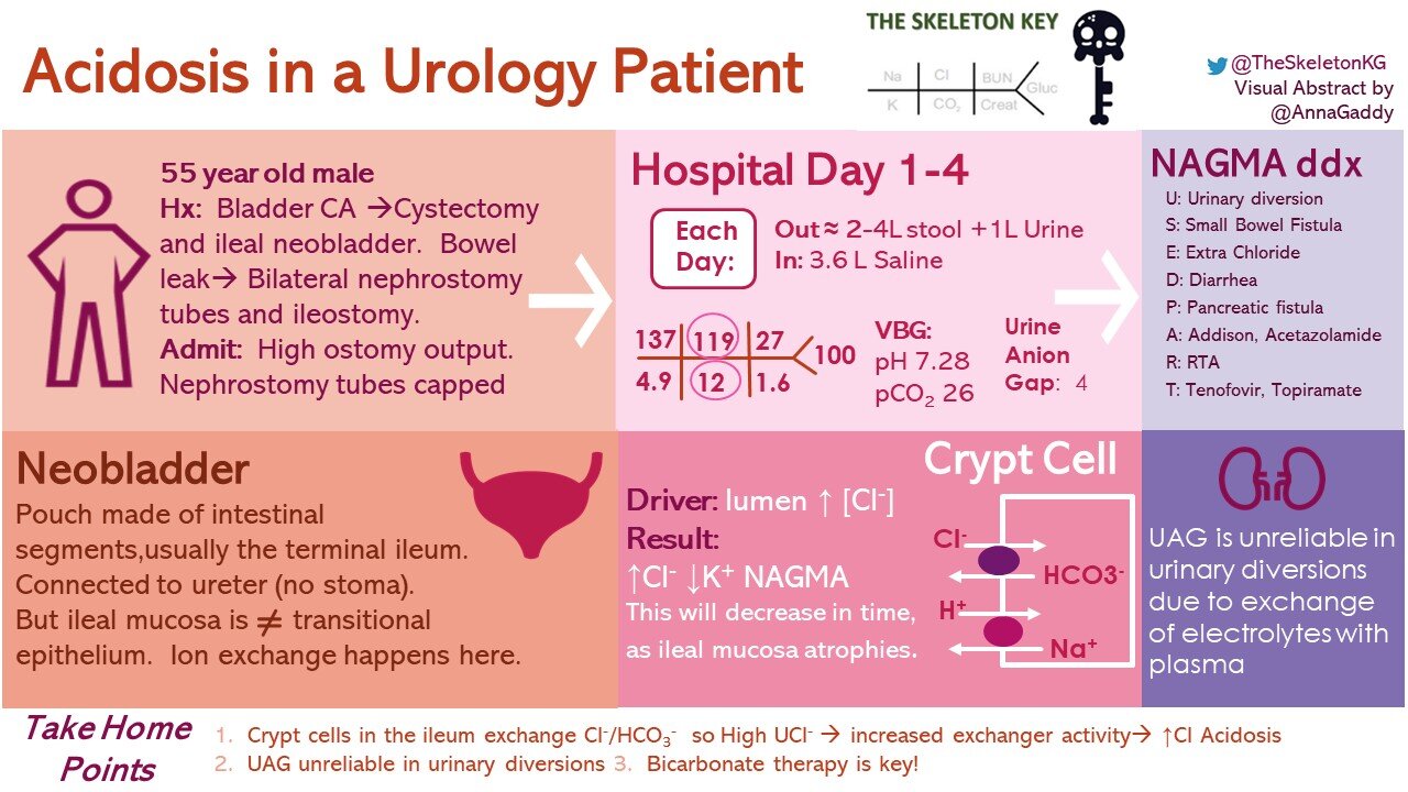 Case 7: Acidosis in a Urology PatientWritten by Sudha MannemuddhuVisual abstract by Kartik Karla