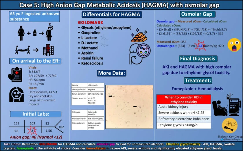 Case 5: High Anion Gap Metabolic Acidosis with Osmolar GapWritten by Jose MenaVisual Abstract by Dhwanil Patel
