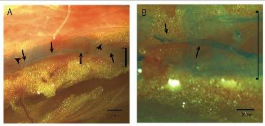 Bonghan duct inside lymphatic vessel (Lee, et al., 2005)