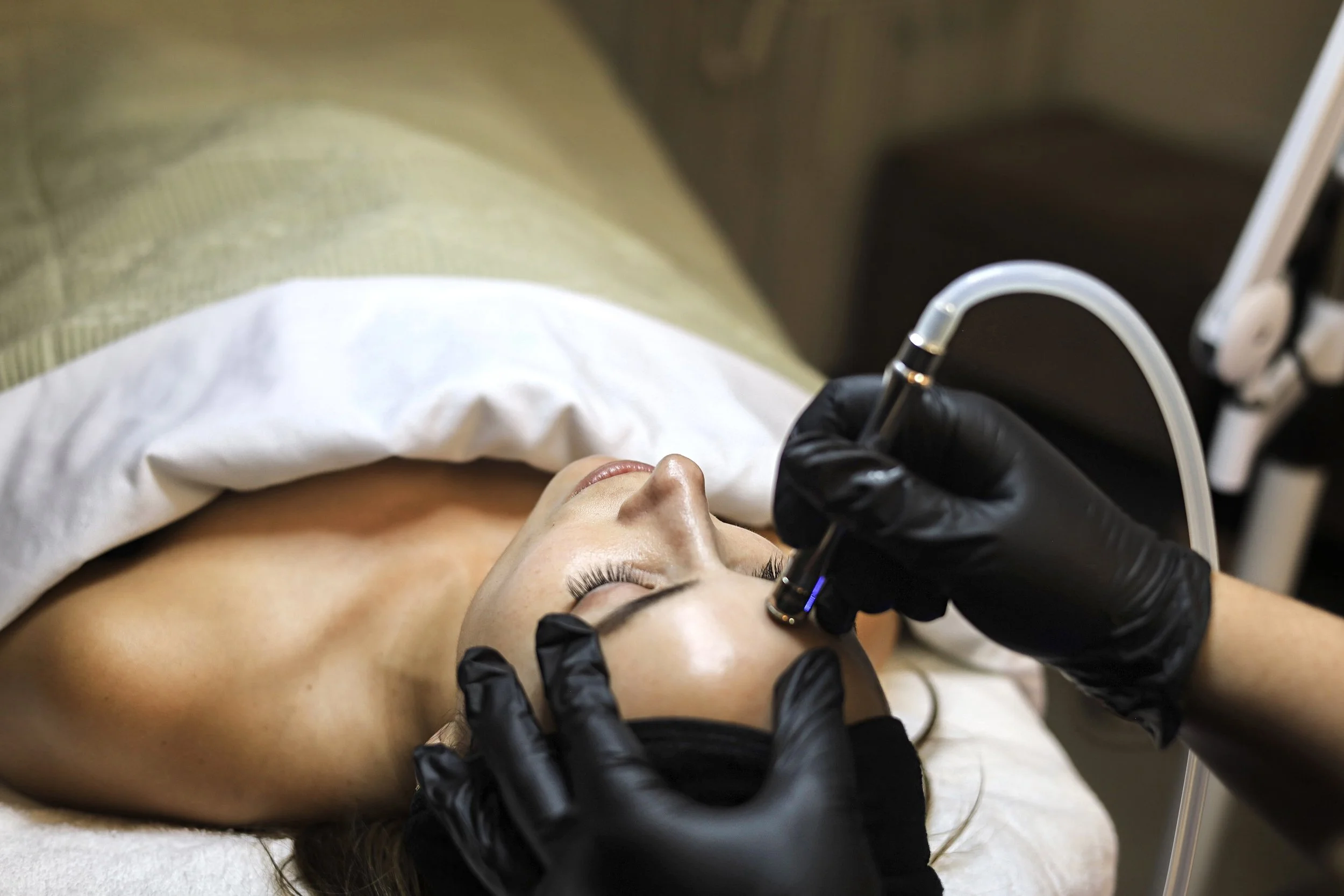 Esthetician performing microdermabrasion