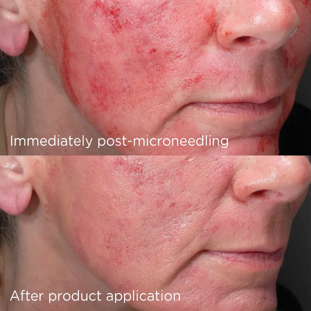 IMAGE_Skincare_DAILY_PREVENTION_Advanced_Smartblend_Mineral_Moisturiser_SPF50_2.webp