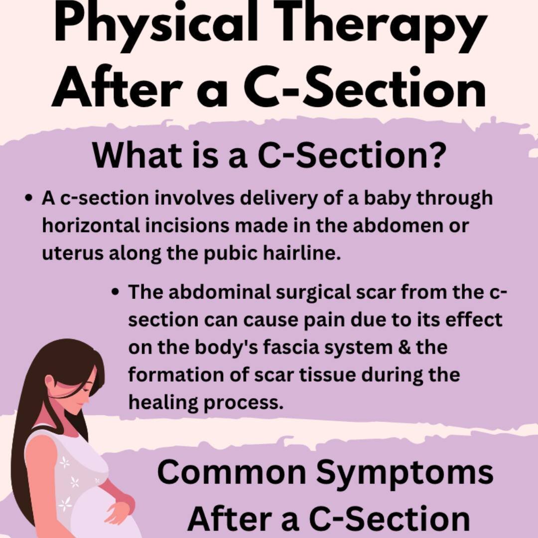 Check out our latest infographic on physical therapy after a c-section: https://bit.ly/physical-therapy-csection-infographic

A C-section is major abdominal surgery involving the delivery of a baby through horizontal incisions made in the abdomen or 