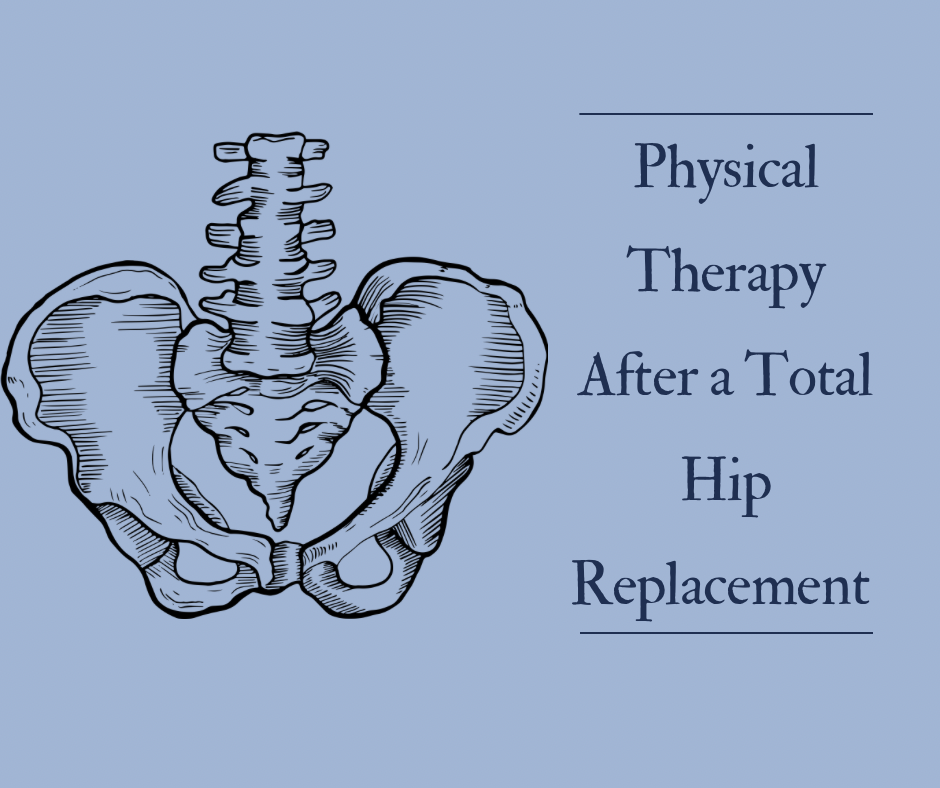 Physical Therapy After a Total Hip Replacement 