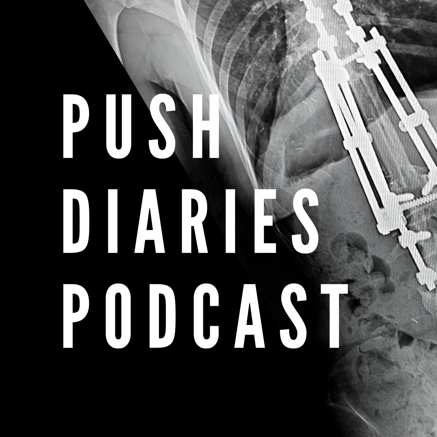Push Diaries Podcast podcast artwork