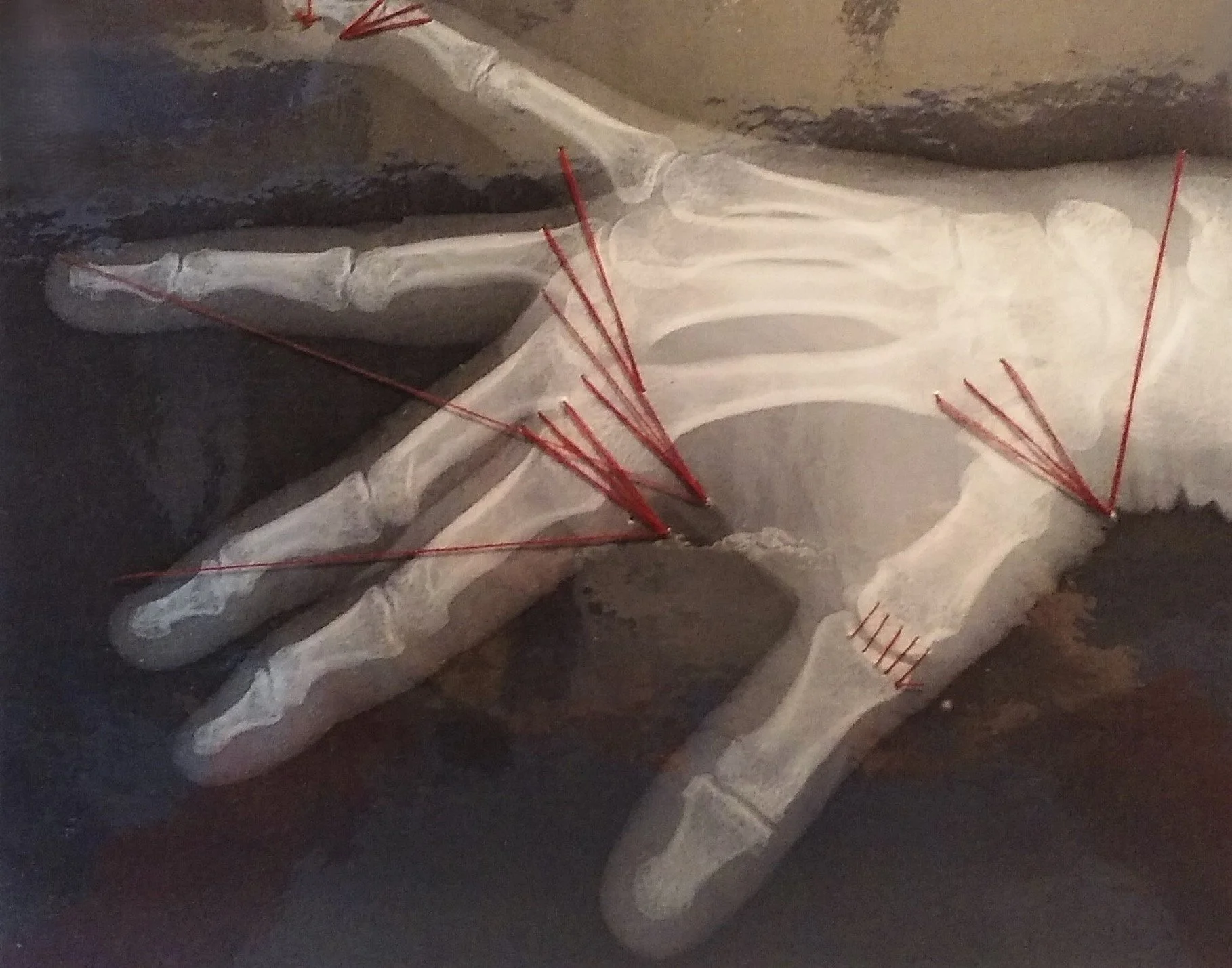 Webster_Sharon_My%20Stitched%20Hand_%202019_%20Lamenated%20xray%2C%20red%20thread%2C%20mounted%20on%20painted%20board._12%20INCHES%20X%2015%20INCHES%20framed_%24300.jpg