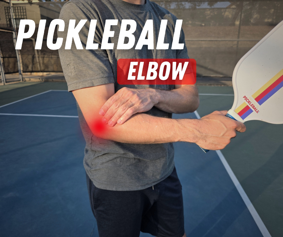 What Is Pickleball Elbow and What Can You Do About It?
