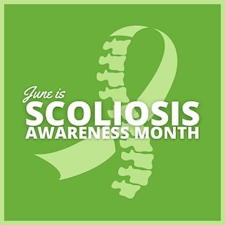 #scoliosis #physio #scoliosisstrong