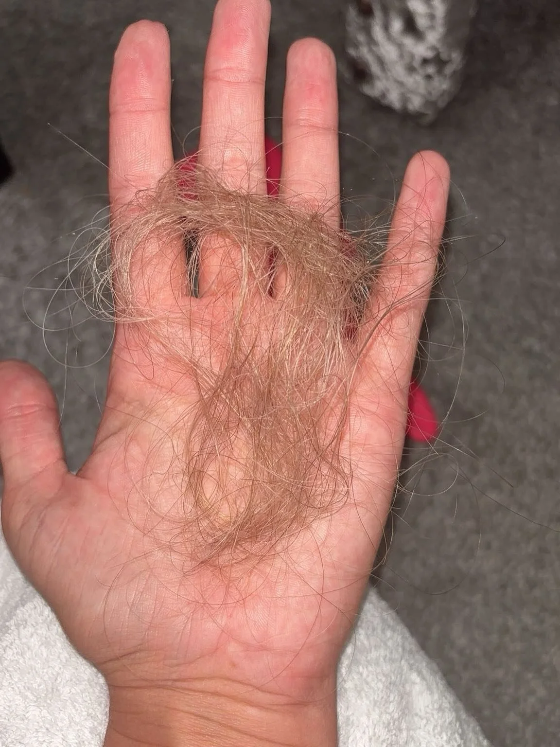 Two photos, one week apart!
 
This lovely lady has been suffering with extreme hair loss. This is such a common thing but rarely spoken about, as women our hair is a huge part of our identity, in all fairness I think the same applies to gents too!
 
