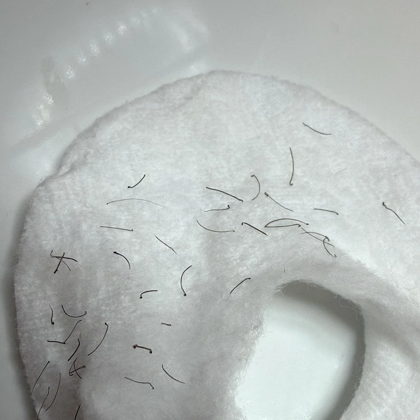 Today&rsquo;s electrolysis hairs removed from a lovely lady&rsquo;s chin
 
Just look at those juicy roots 🤤
 
#permanenthairremoval #electrolysishairremoval