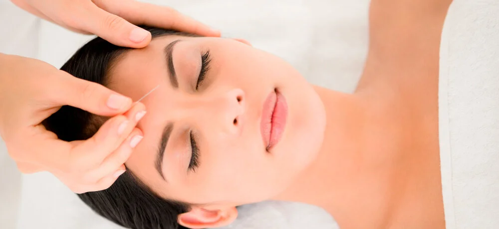 Women Receiving Acupuncture