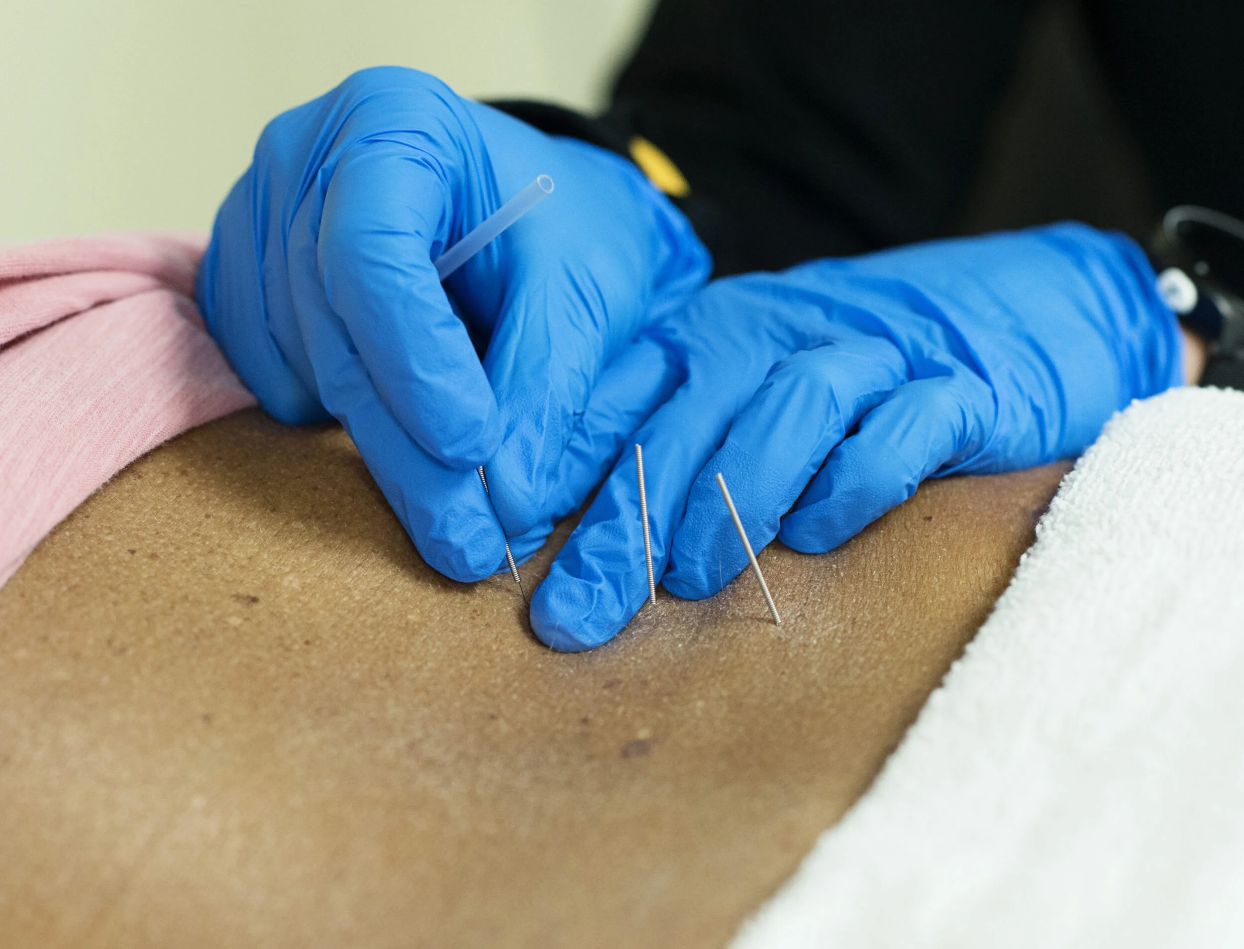 Gorgeous Dry Eye Syndrome And Contacts Moment Nature Gorgeous Dry Eye Syndrome And Contacts Moment Nature