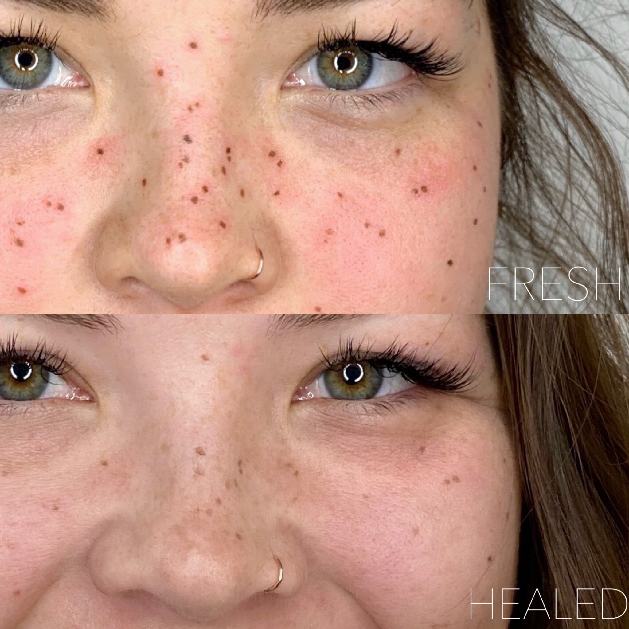 Freckles Beauty Marks — Saki Lee