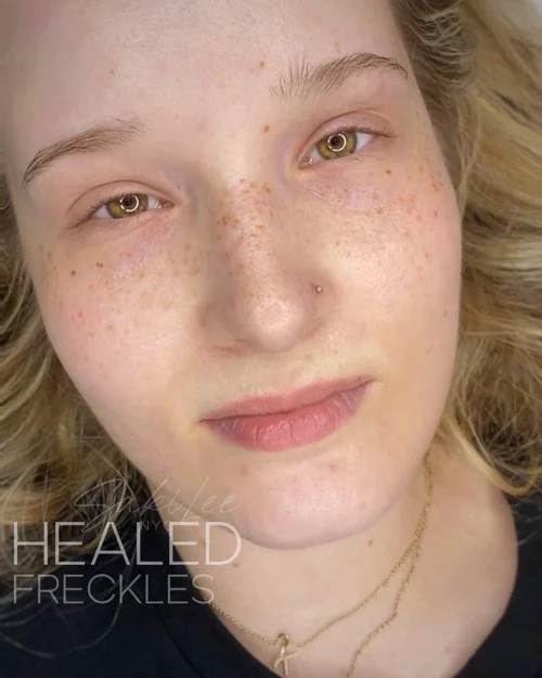 FRECKLES/BEAUTY MARKS — SAKI LEE