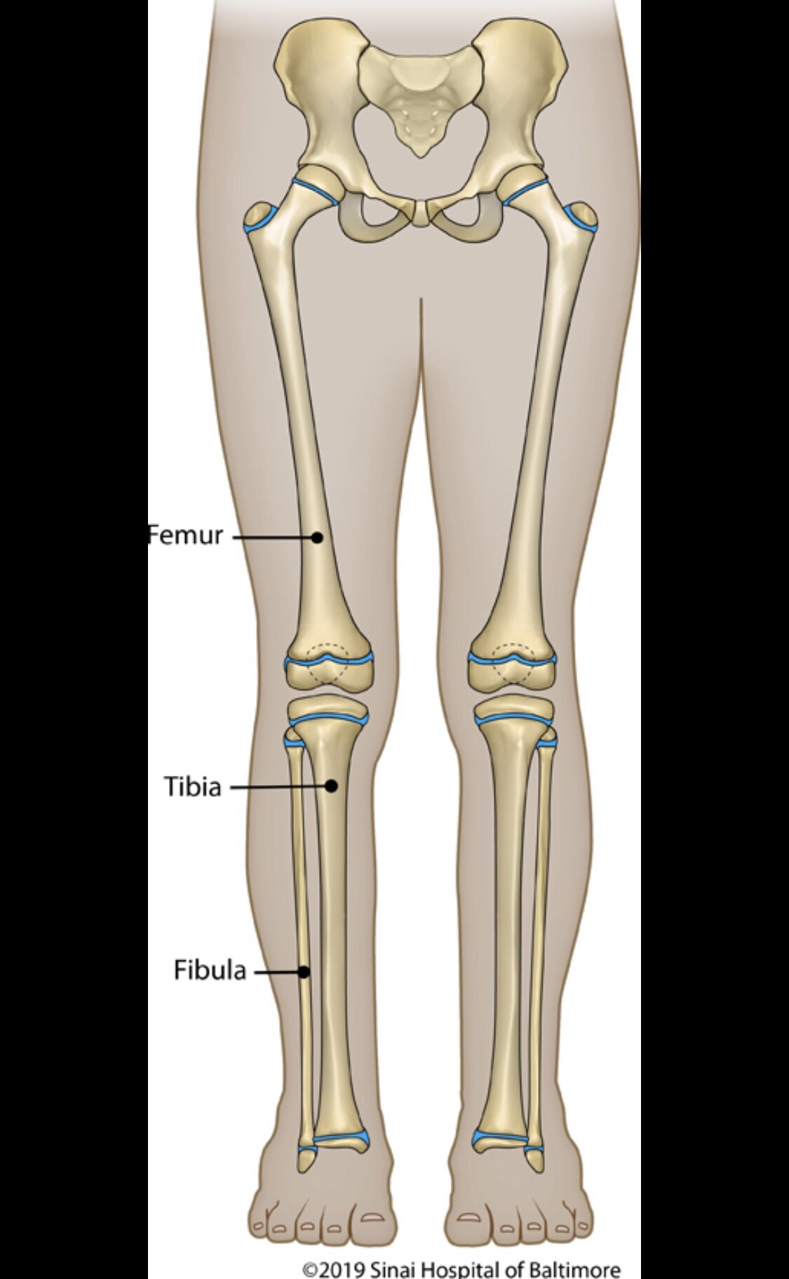 Пластина роста. Зона роста большеберцовой кости. Метаэпифизарная дисплазия лучевой кости. Большеберцовая кость зоны роста. Зоны роста костей у детей.
