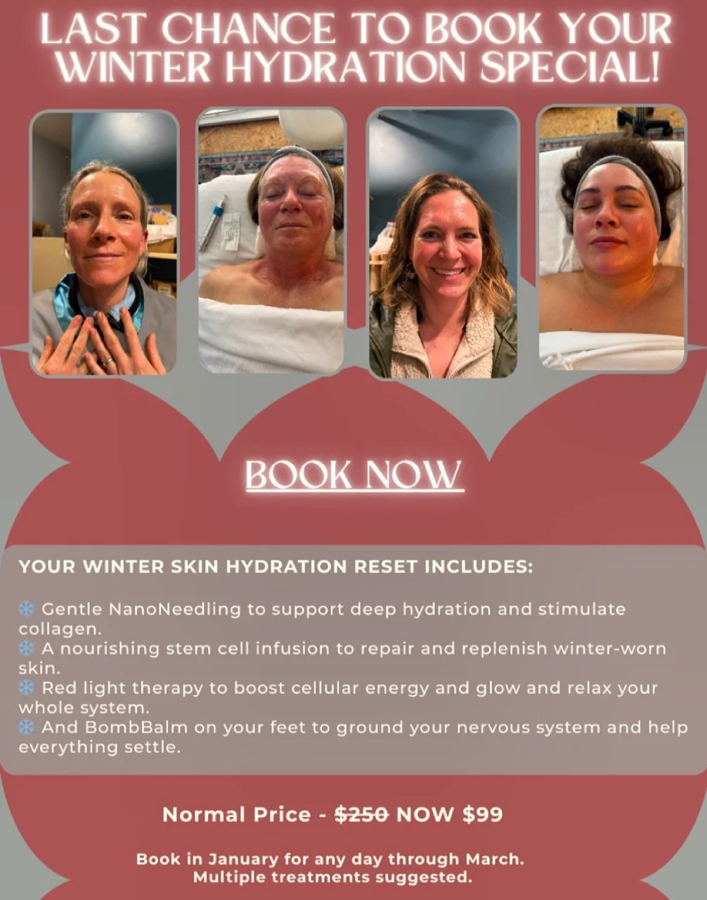 ⏰Limited time to book the very  popular Winter Special that is making the driest of skin GLOW with hydration! 

YOUR WINTER SKIN HYDRATION RESET INCLUDES:
*  Gentle NanoNeedling to support deep hydration and stimulate collagen.
*  A nourishing stem c