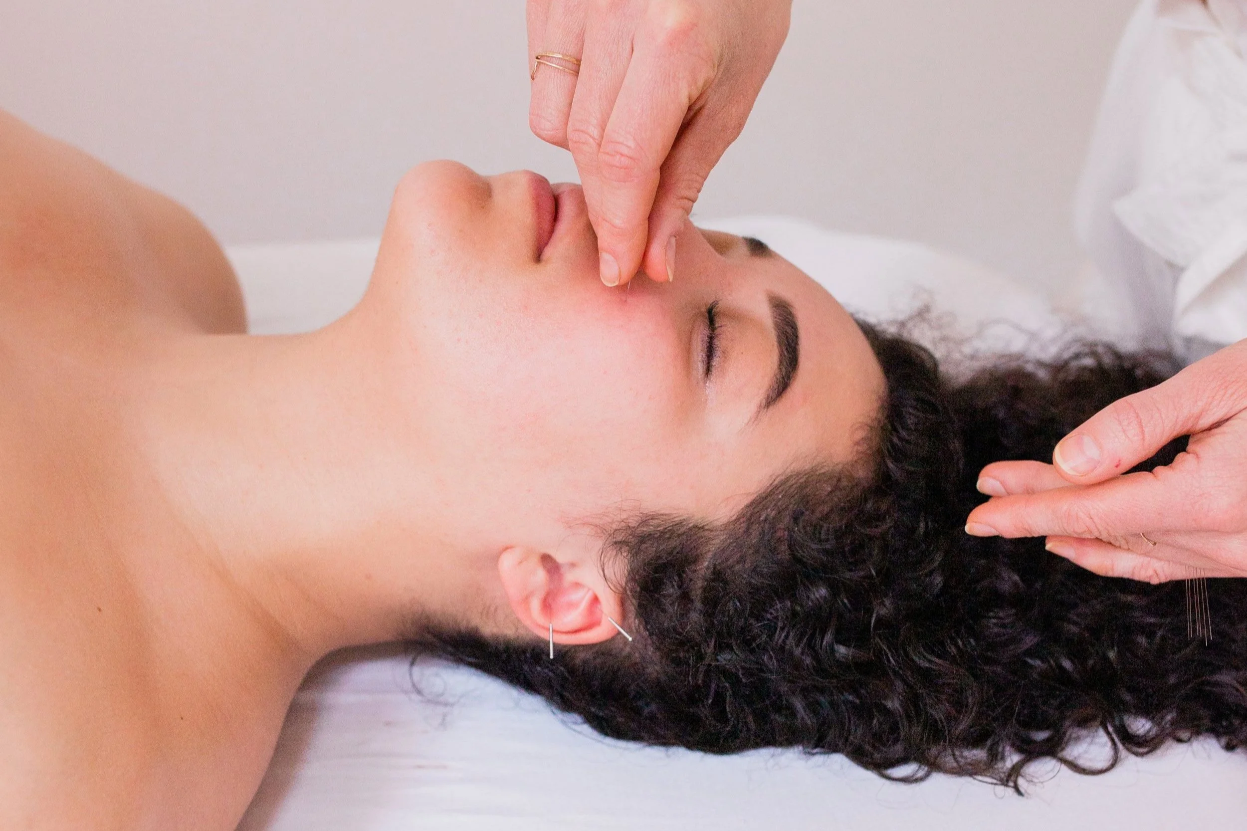 PDX Acupuncture