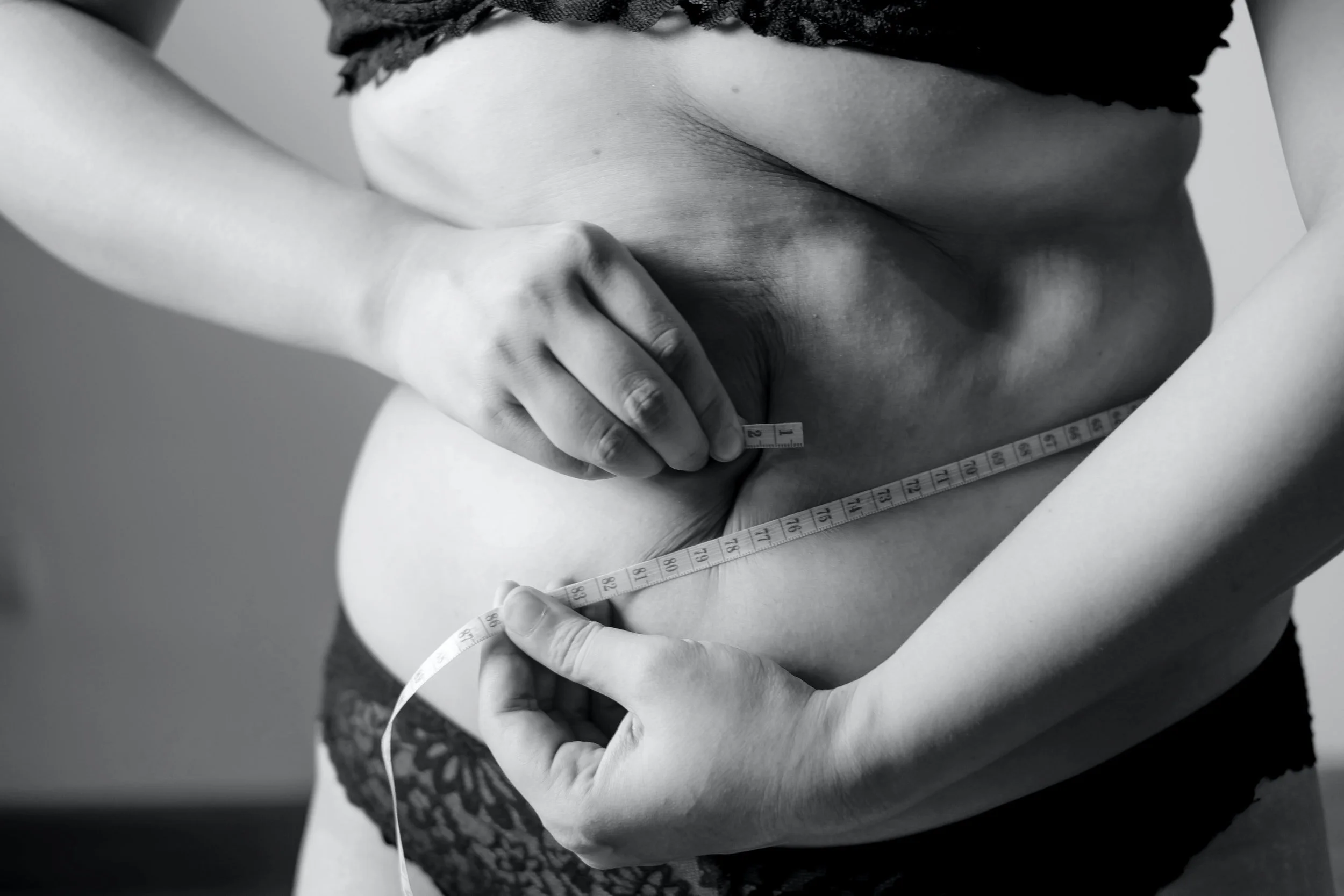 Weight loss with acupuncture