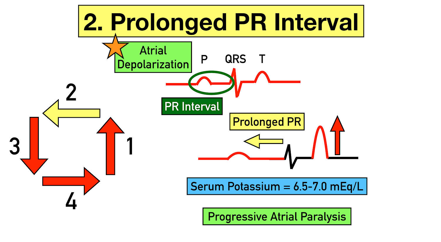 Hypokalemia Ecg Google Search Hyperkalemia Acls Study vrogue.co