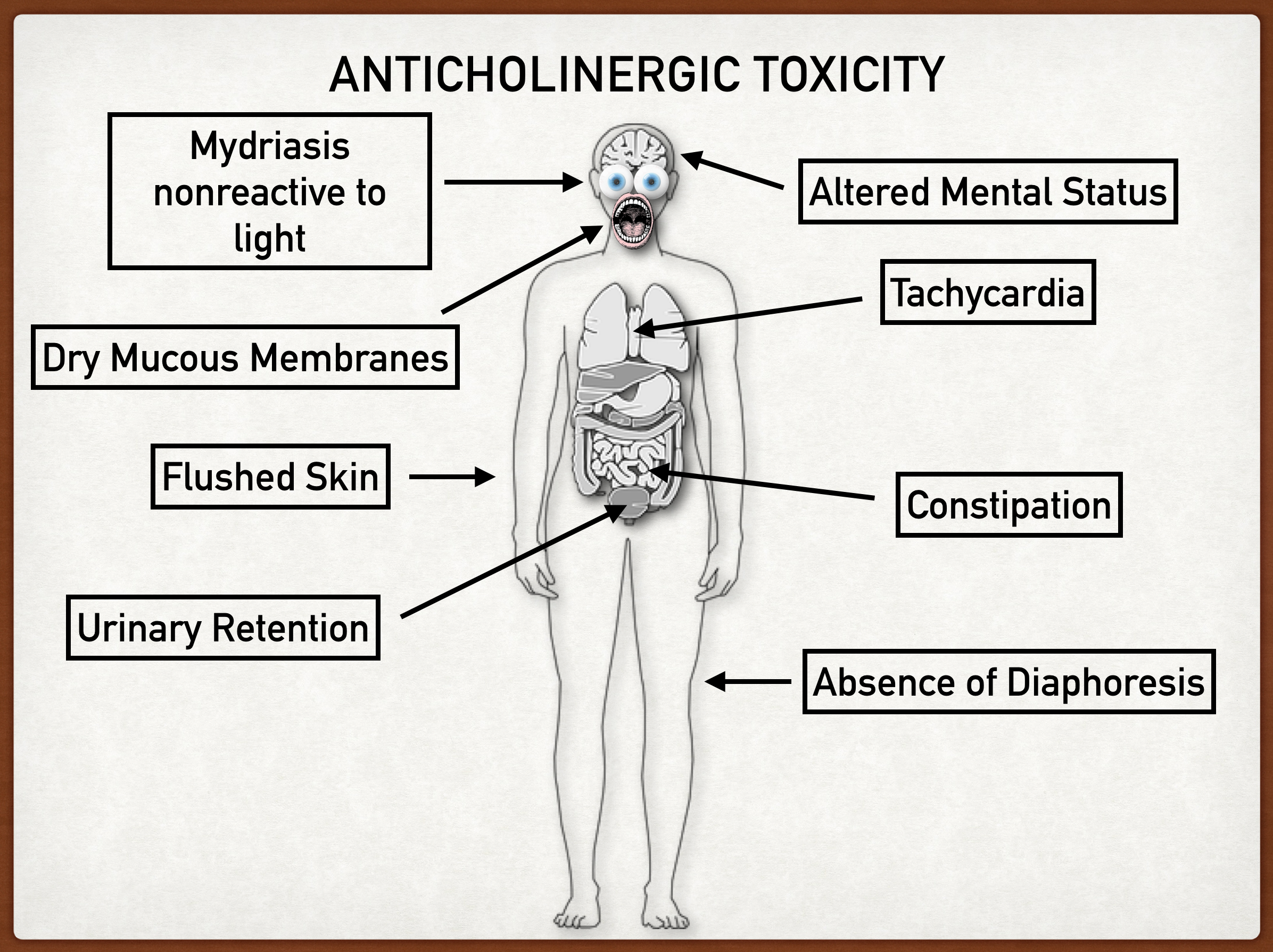 Anticholinergic Drug Toxicity Syndrome Symptoms Causes Treatment Medication Effects For Usmle Ezmed Anticholinergic Drug Toxicity Syndrome Symptoms Causes Treatment Medication Effects For Usmle Ezmed