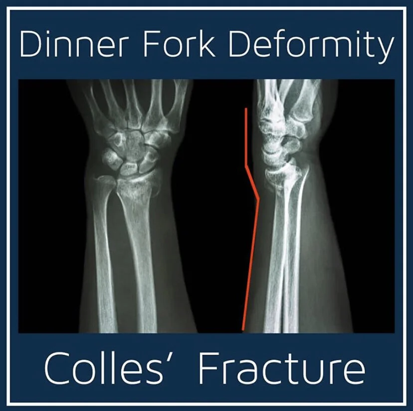 10 High Yield Buzzwords for Step Exams and Board Study