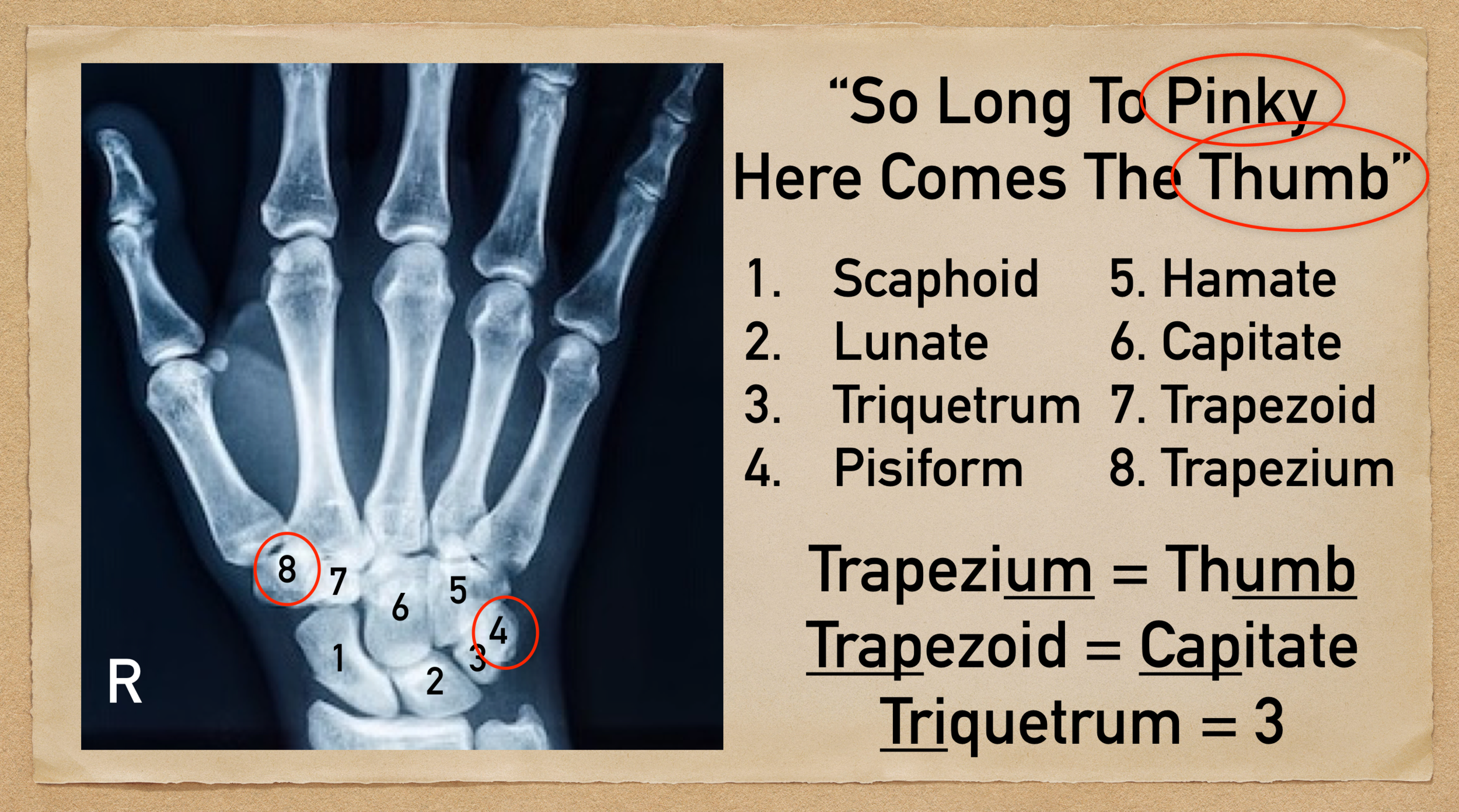 Carpal Bone Mnemonic And Names Wrist Anatomy Made Easy Ezmed