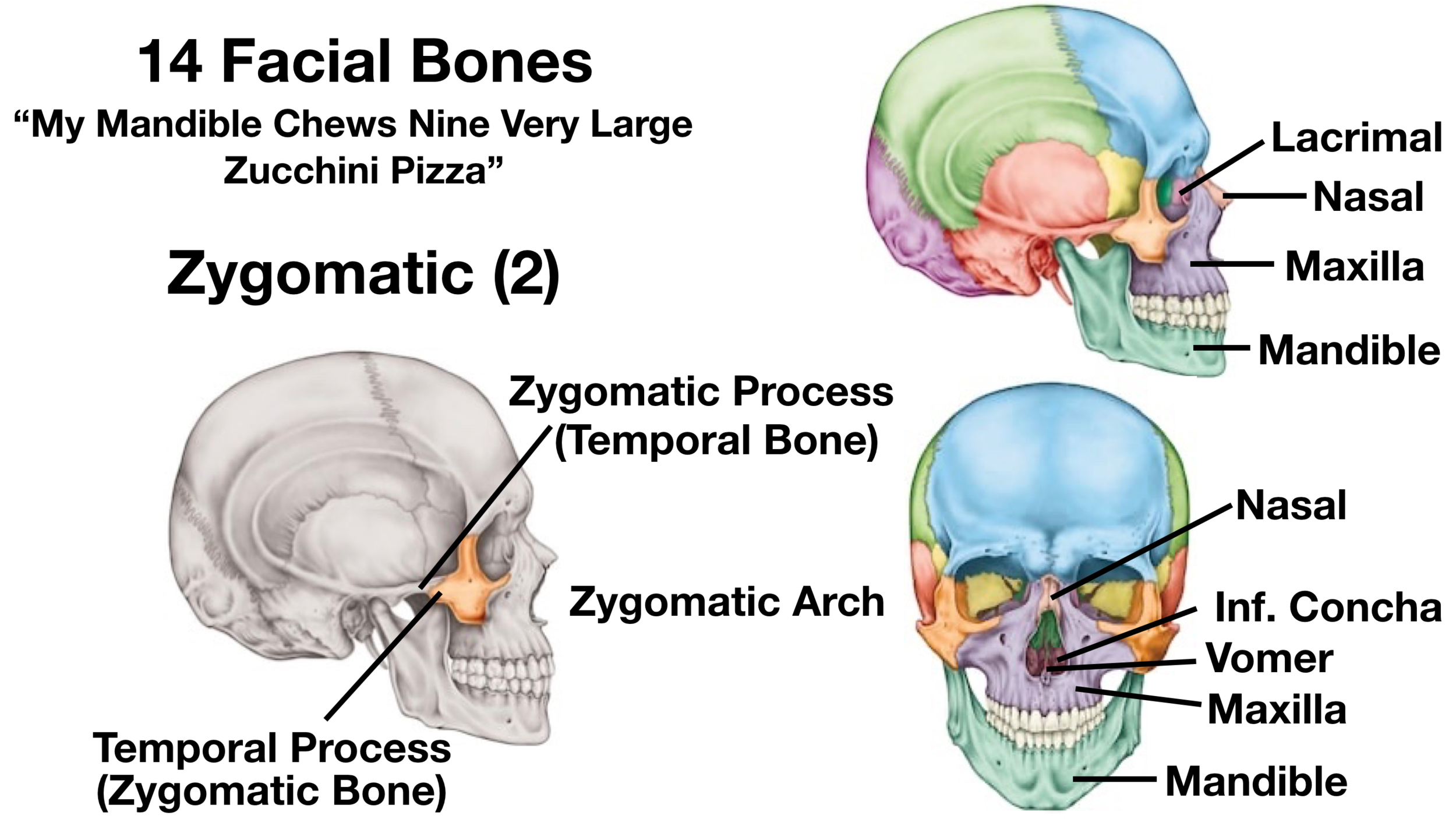zygomatic bone maxillary process