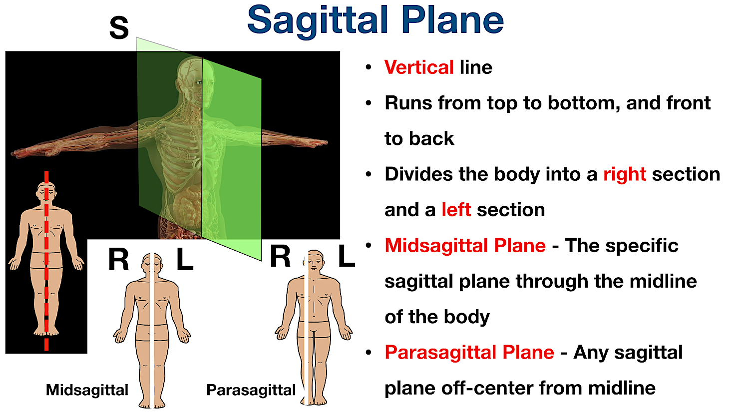 Midsagittal Plane