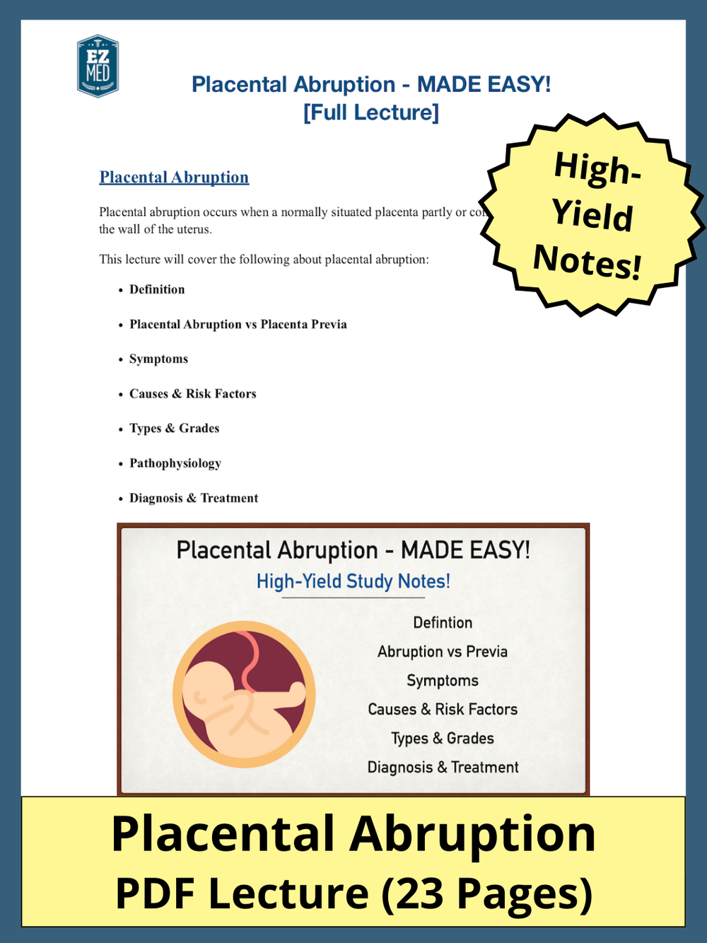 placental abruption pdf symptoms causes treatment types grades diagnosis