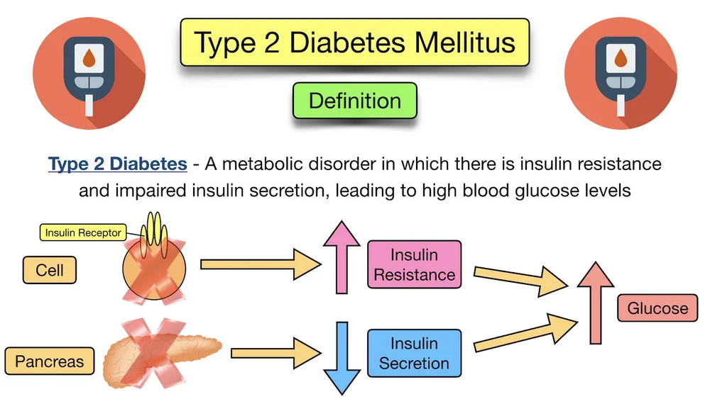 Type 2 Diabetes Mellitus Symptoms, Diet, Medication, Treatment, Risk