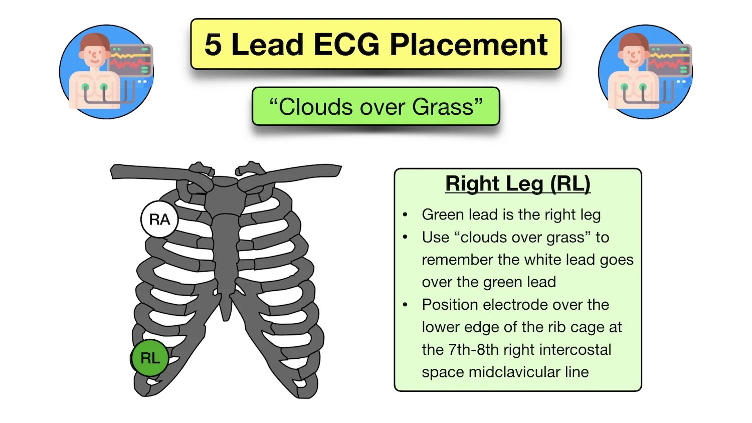 How to Place a 5 Lead ECG Acronym, Mnemonic, Diagram for Electrode