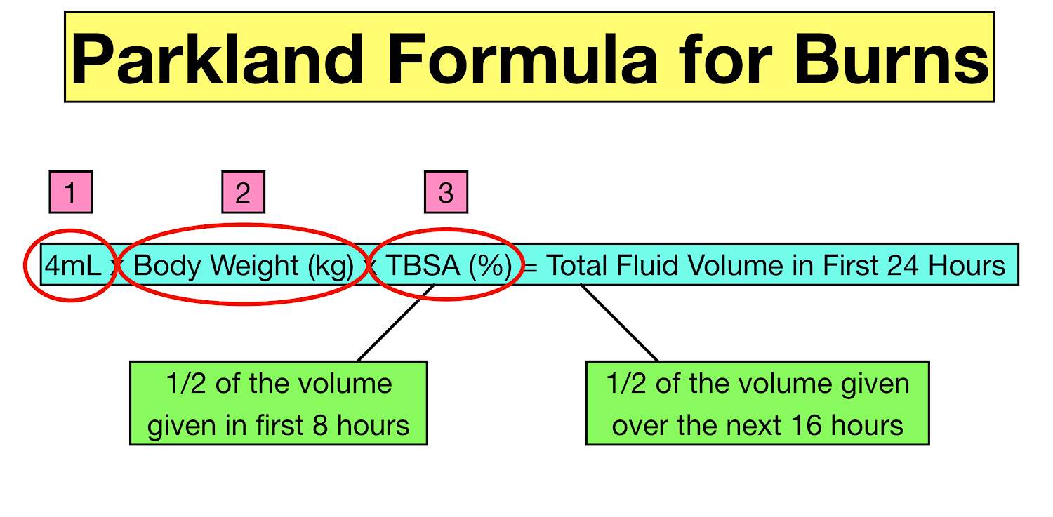 Parkland Formula for Burns: Pediatric and Adult Examples, Calculator