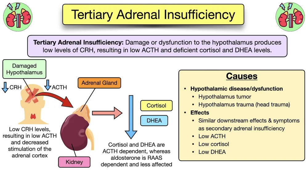 Adrenal Insufficiency Symptoms, Causes, Treatment, Diagnosis, Labs
