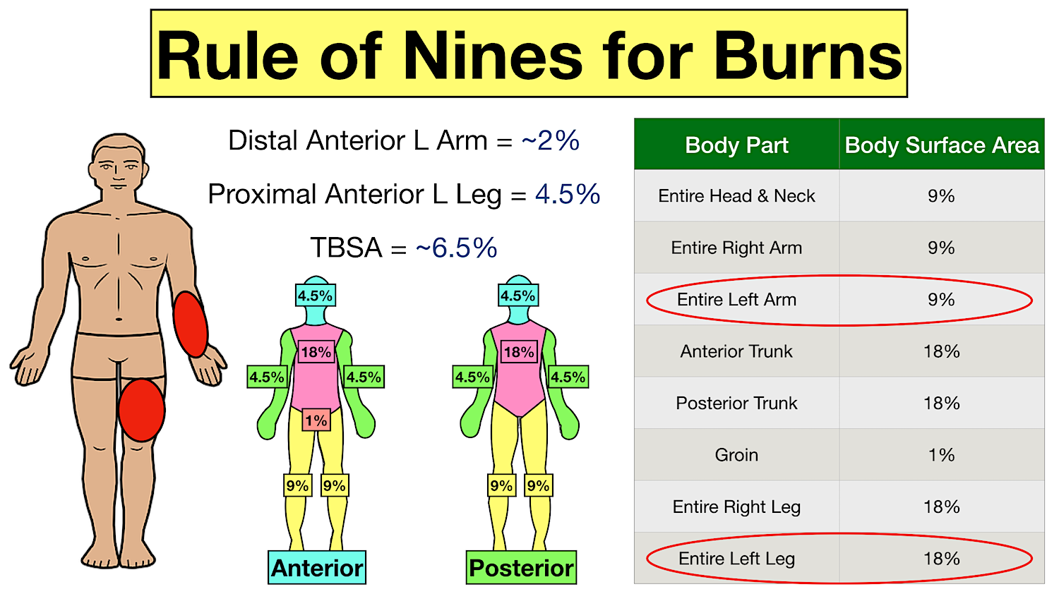 Rule Of Nines For Burns Child And Adult Chart Calculator Definition