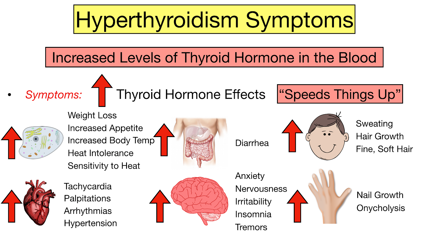 symptoms of hyperthyroidism