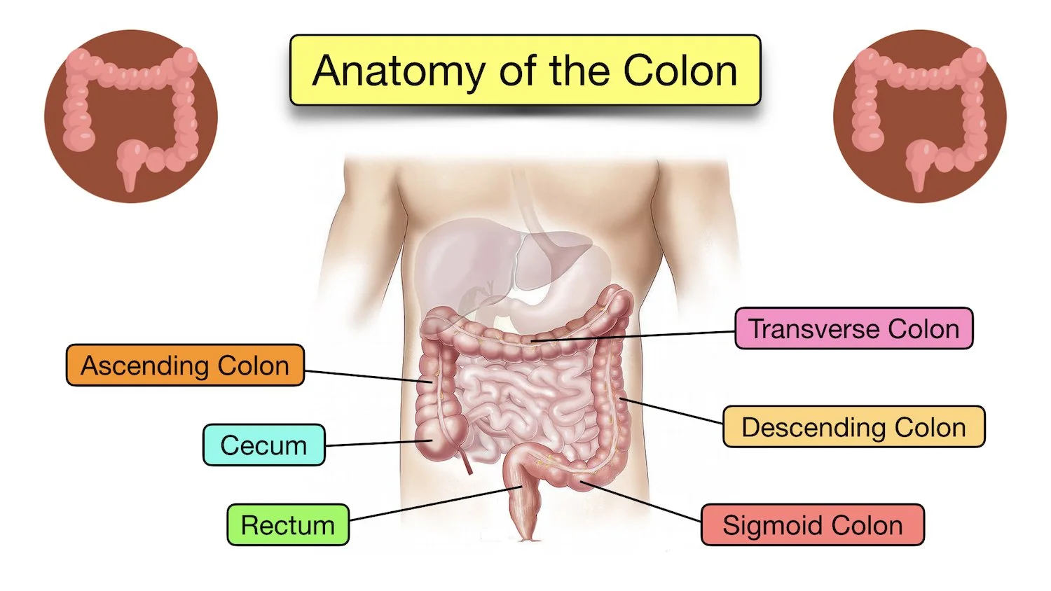 Diverticular Disease Diverticulitis vs Diverticulosis Symptoms, Diet