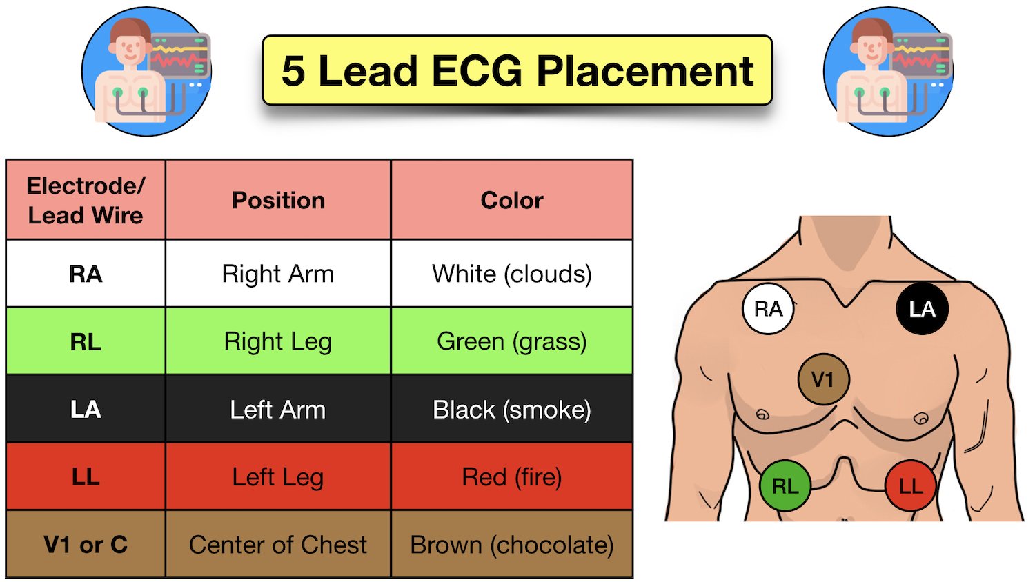 12 lead ecg placement mnemonic