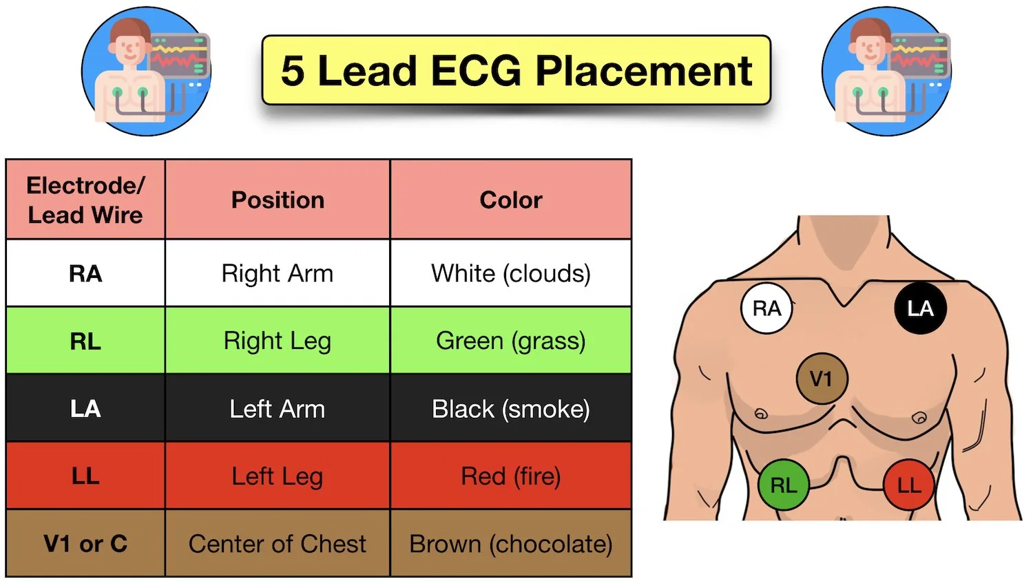How to Place a 5 Lead ECG Acronym, Mnemonic, Diagram for Electrode
