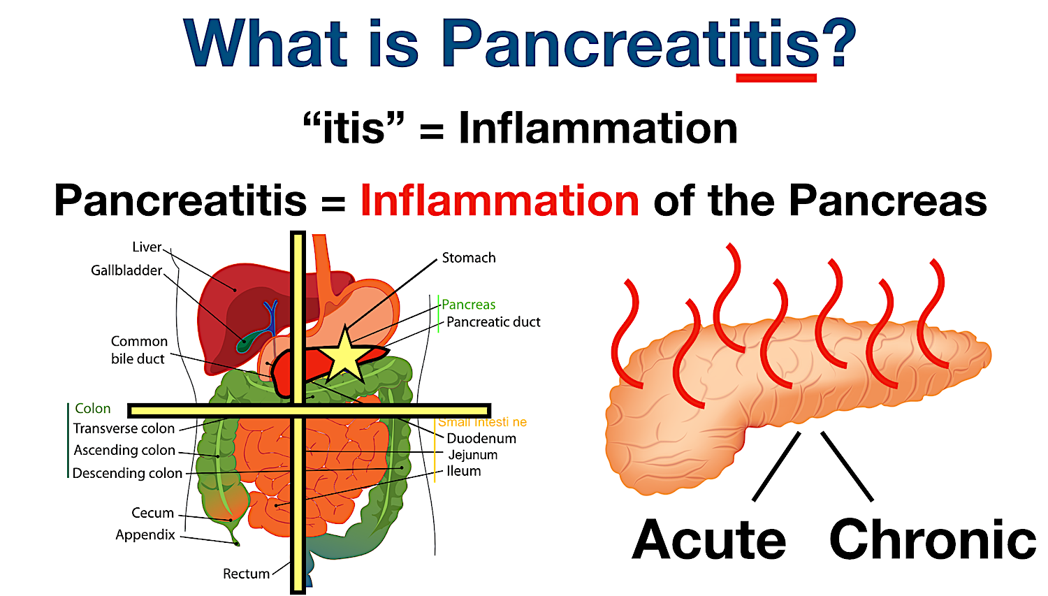 Pancreatitis Pain Symptoms, Causes, Treatment, Diet, Location