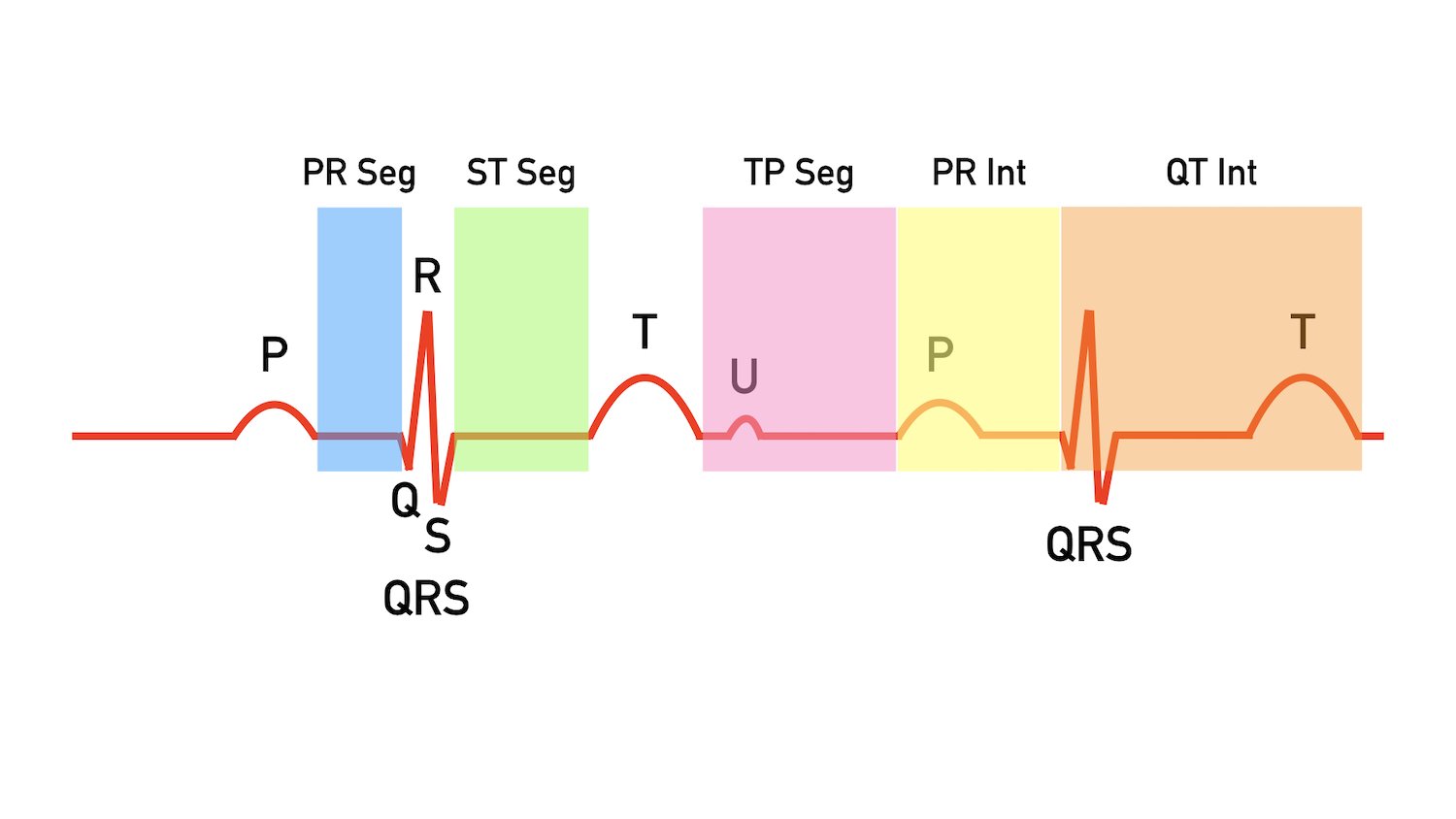 ECG Waveform Explained EKG Labeled Diagrams and Components — EZmed