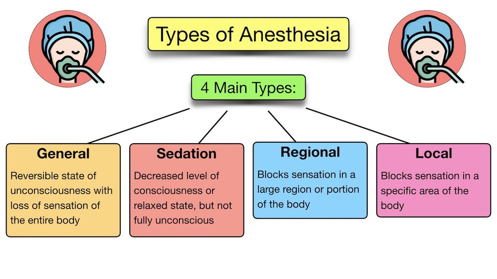 General Anesthesia vs Sedation Definition, Drugs, Side Effects, List of Example Medications