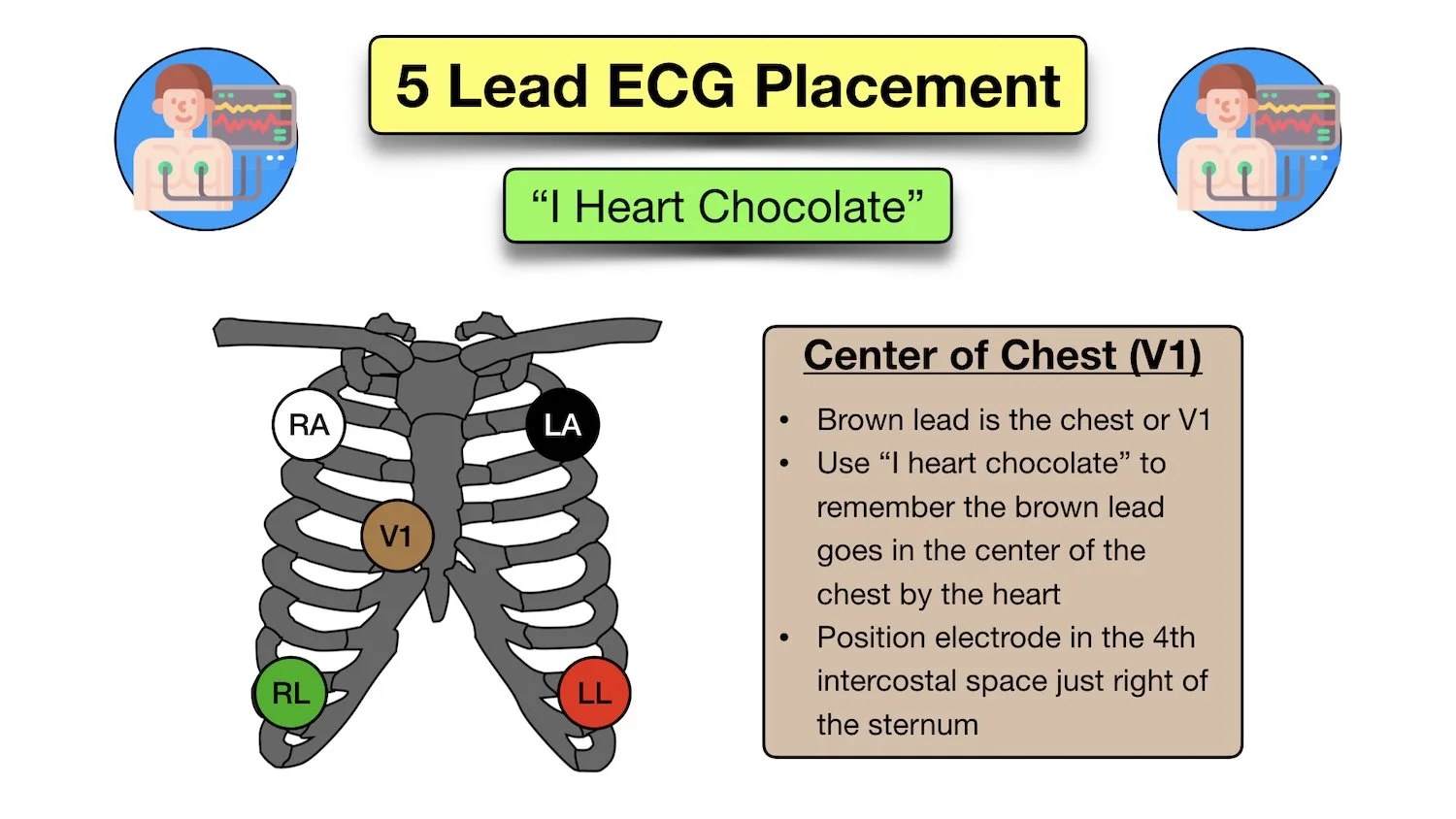 12 Lead Ecg Placement Color Coded